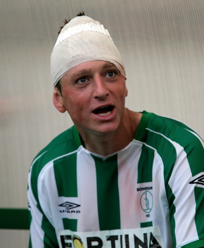 Tomáš Hrdlička dohrál s tržnou ránou na hlavě.