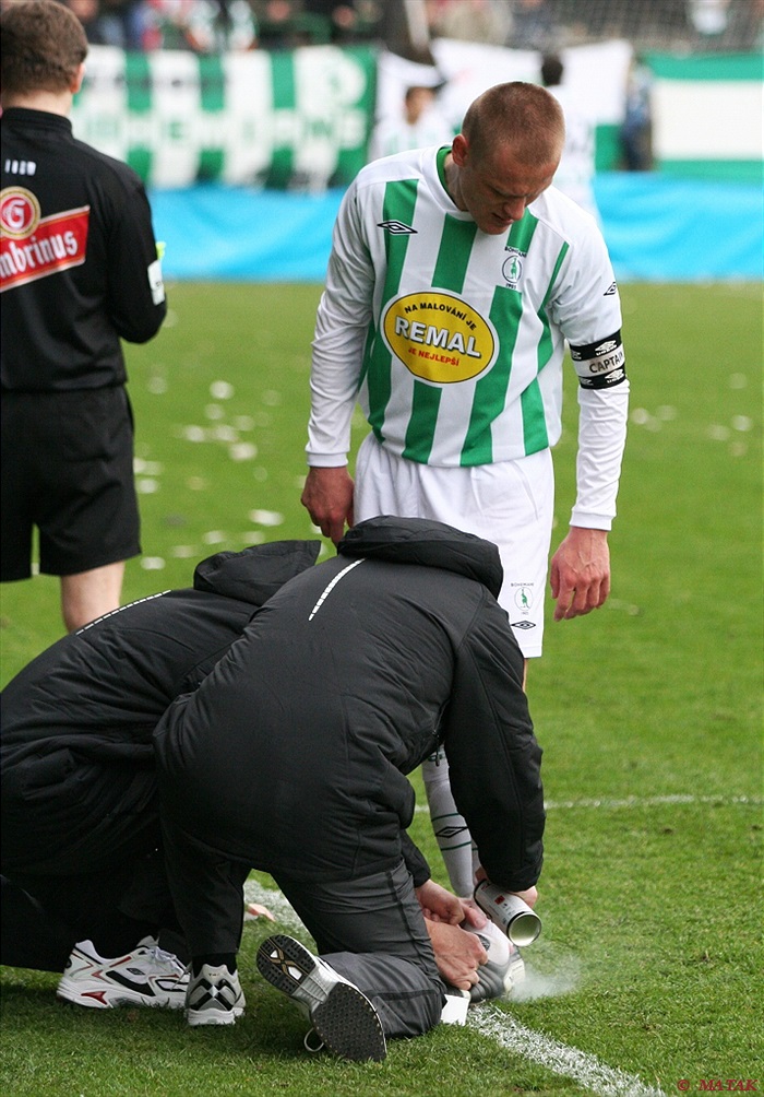 Zraněný kotník Dalibora Slezáka.