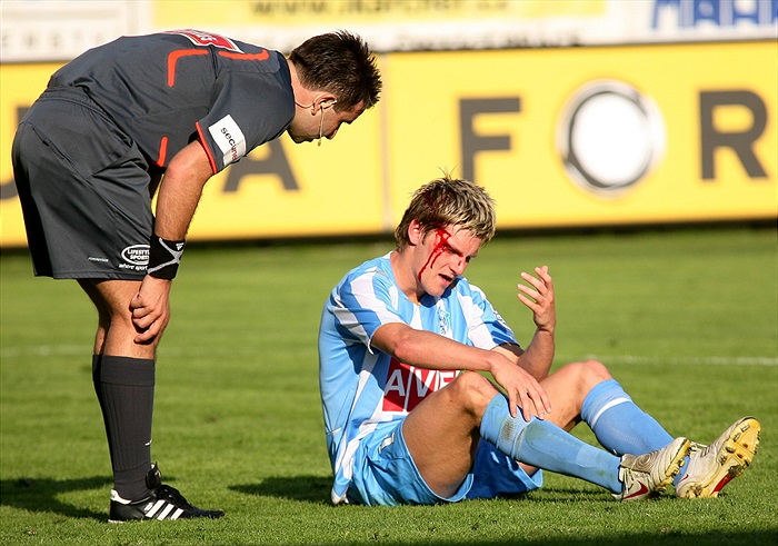 Krvavý Ondrášek po standardní situaci.