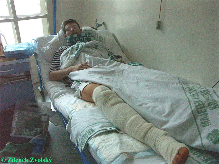 Bartolomej Berci Gonos po operaci 21.02.2006  1