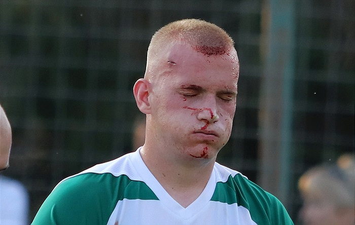 Zápy - Bohemians 2:3 (0:1)